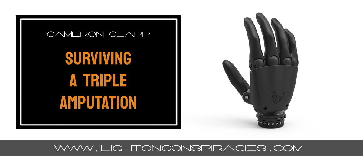 surviving a triple amputation: cameron clapp light on